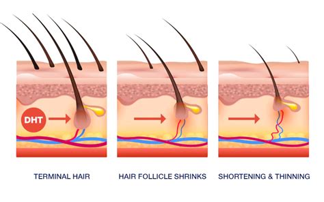 does omega-3 block dht